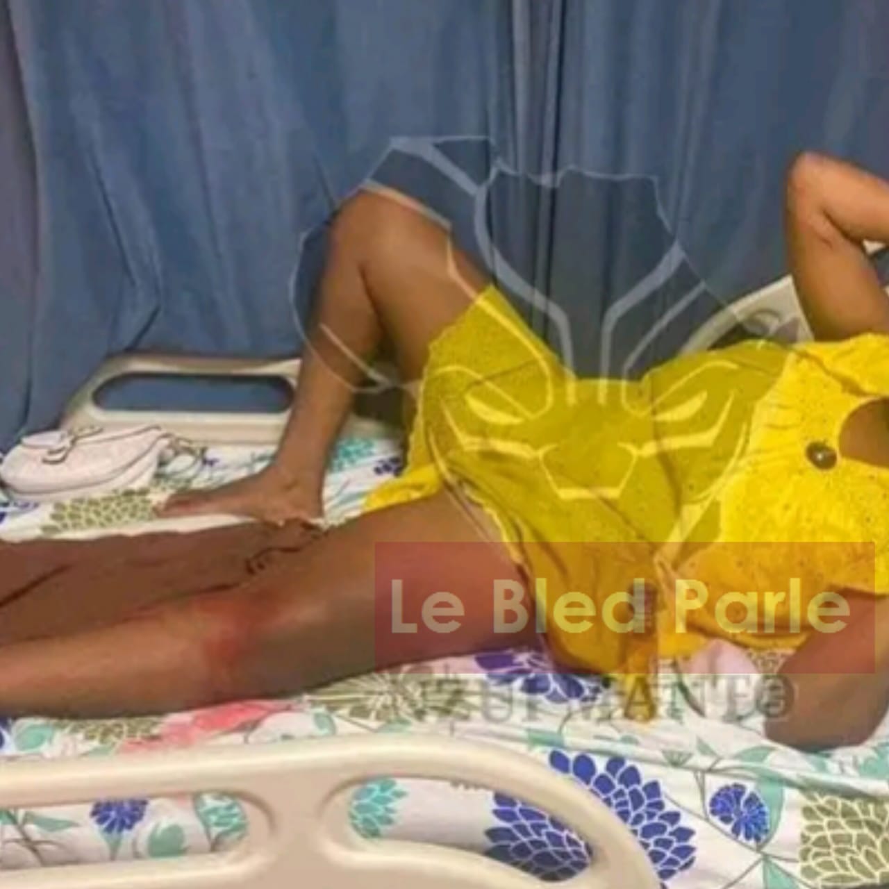 Photo d'illustration : Une patiente sur le lit d'hôpital - Droits Réservés